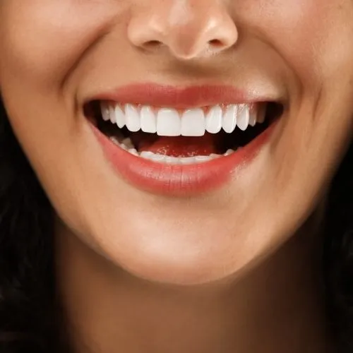 Smiling patient showing natural-looking teeth after dental bridge restoration at Hanlon Creek Dental in Guelph.
