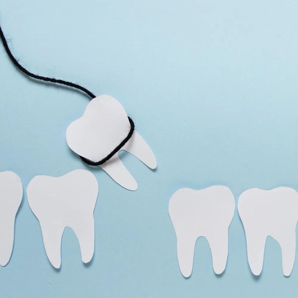 Illustration of a tooth being pulled with a floss-style string, representing tooth extraction at Hanlon Creek Dental in Guelph, ON