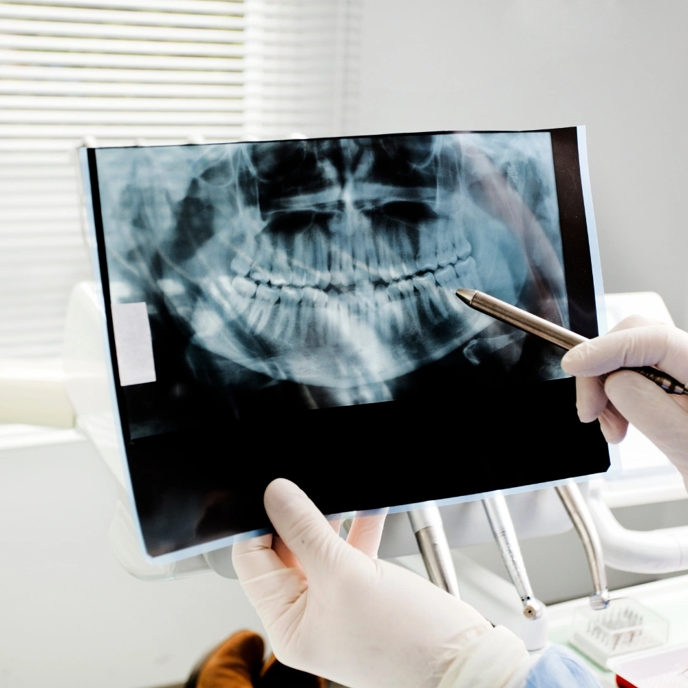Dentist reviewing a panoramic dental X-ray to assess teeth and jaw health at Hanlon Creek Dental in Guelph, ON