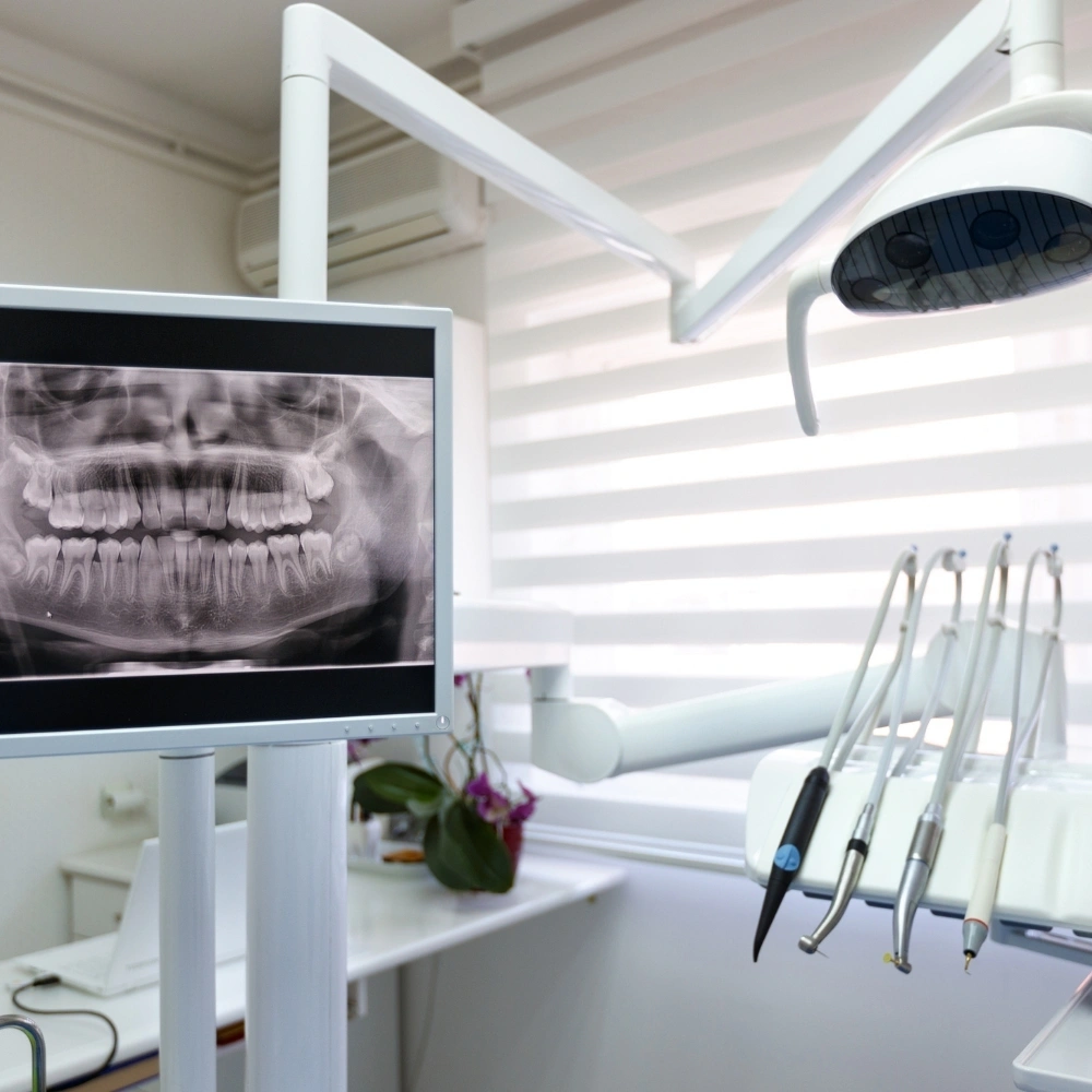 Dental X-ray displayed on screen beside treatment chair and dental instruments at Hanlon Creek Dental in Guelph, ON.