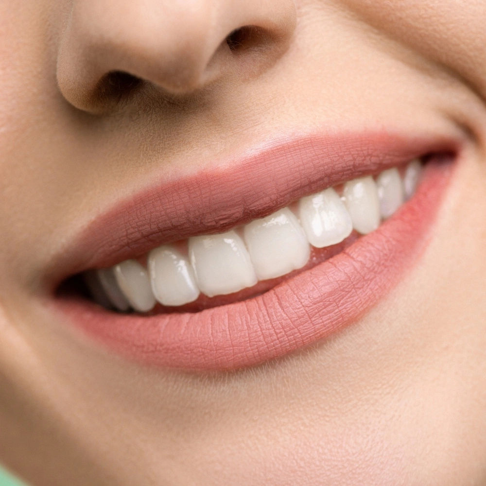 Close-up of a bright, confident smile after cosmetic dental treatment at Hanlon Creek Dental in Guelph, ON