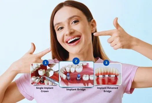 Smiling patient pointing to options for dental implants showing single implant crown, implant bridge, and implant-retained bridge at Hanlon Creek Dental in Guelph, ON.